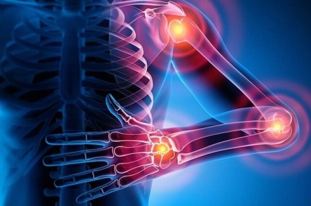 Umbilical Cord Cell–Based Therapy for Osteoarthritis / Iranian Product “WhartoCell” Introduced into Clinical Practice